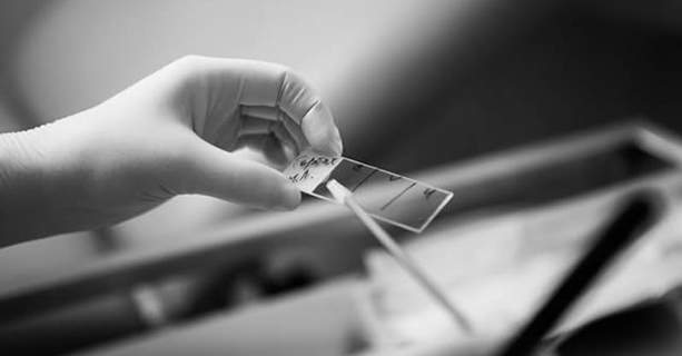 Аналіз на ТТГ у Києві - тиреотропний гормон